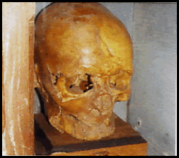 Skull of Simon de Sudbury skull